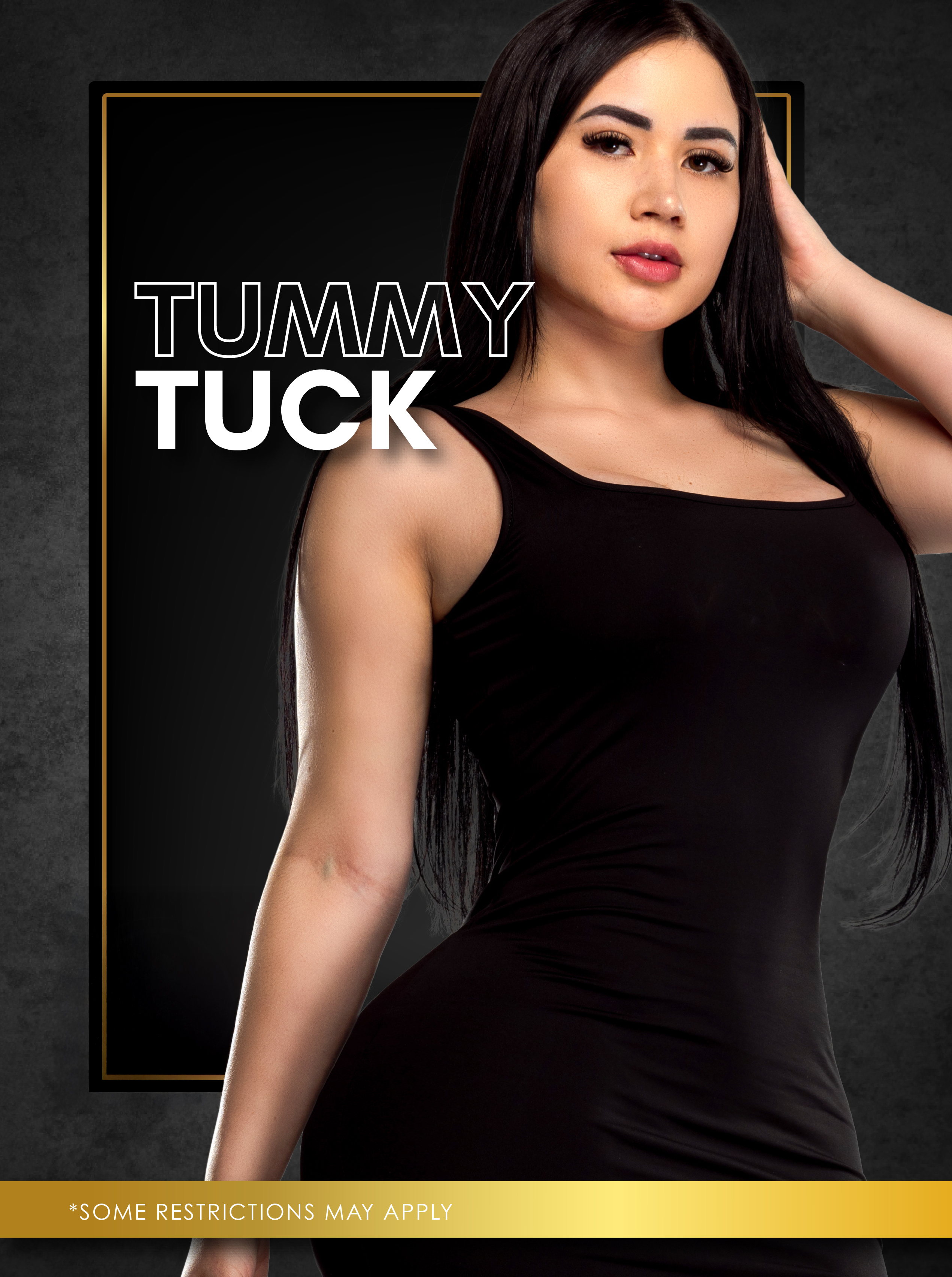 Tummy Tuck (Dallas)